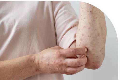 B_Mejora_enero_febrero28_destacada